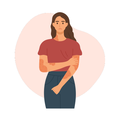Shingles Vaccine
